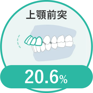 上顎前突