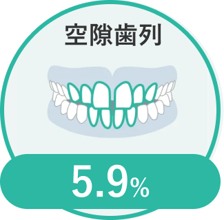 空隙歯列